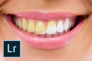 Como clarear Dentes no Lightroom – Tutorial Passo a Passo
